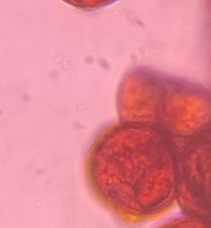 Microscope image of Grass — pollen (gallery) — verified by PollyMap