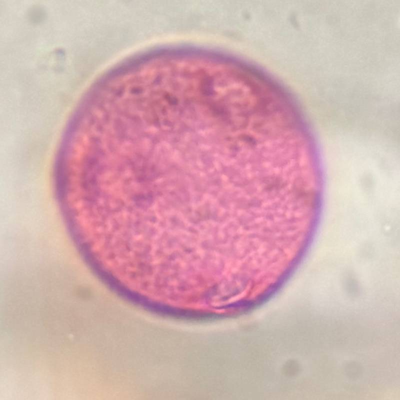 Microscope image of Plantain — pollen (reference) — verified by PollyMap