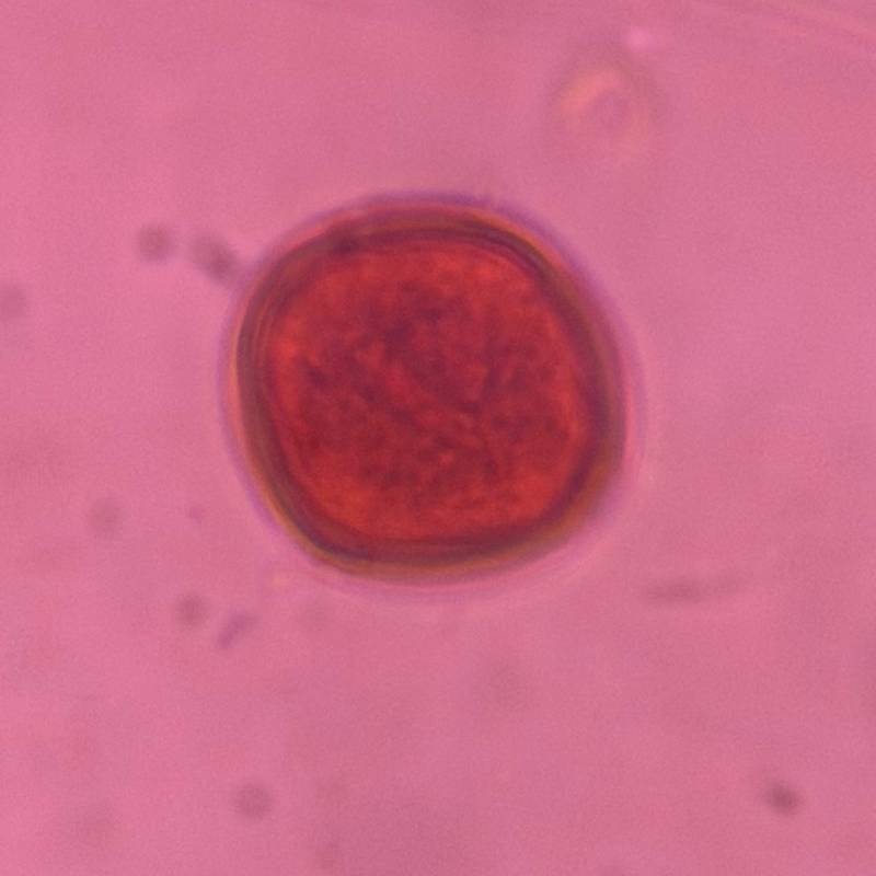 Microscope image of Oak — pollen (gallery) — verified by PollyMap