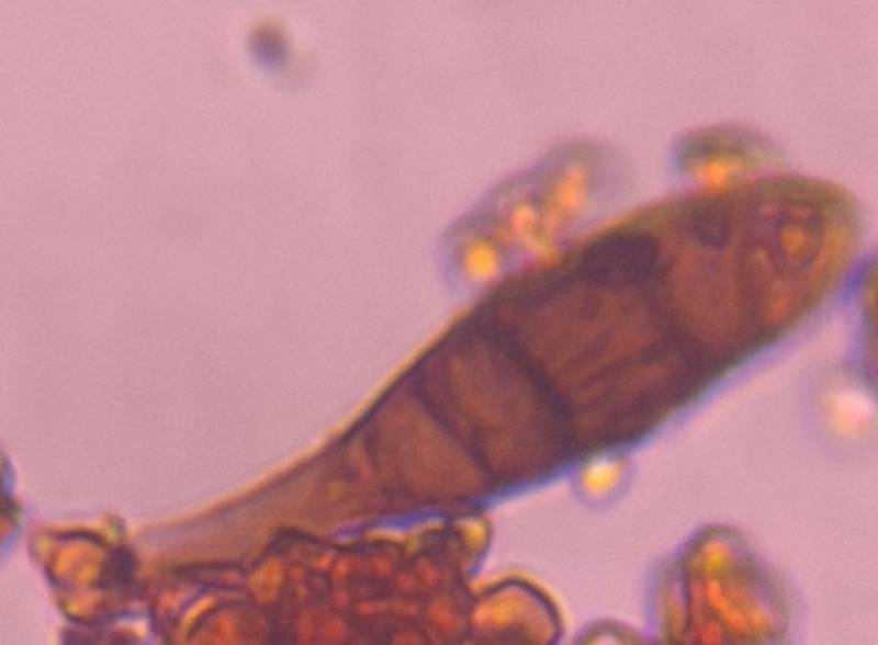 Microscope image of Alternaria — mold (gallery) — verified by PollyMap