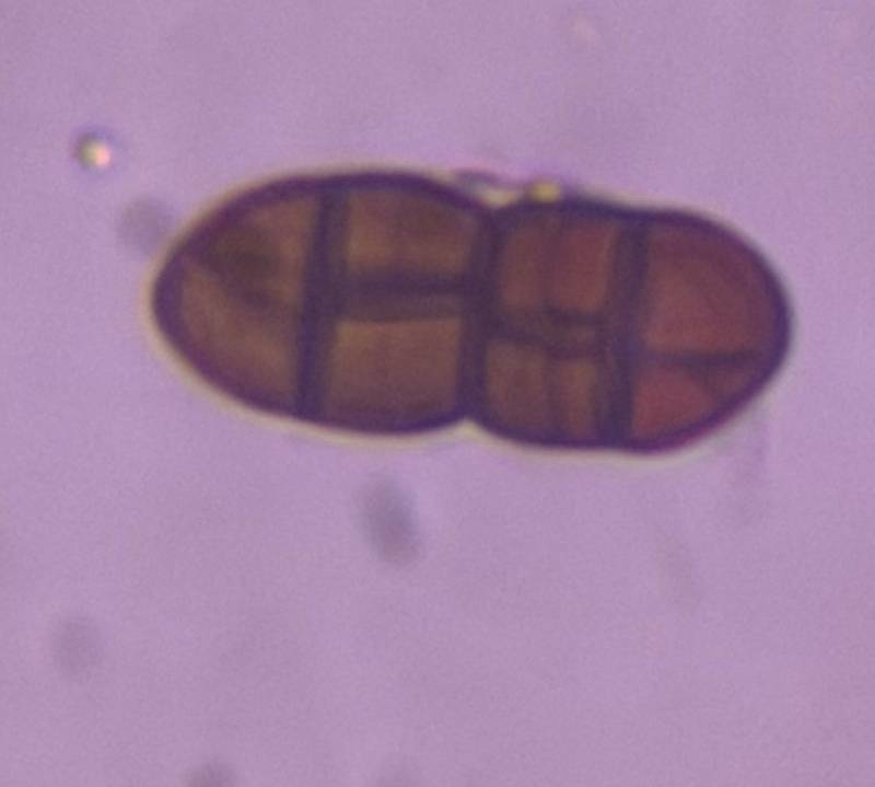 Microscope image of Pithomyces — mold (gallery) — verified by PollyMap