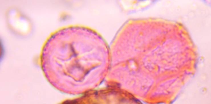 Microscope image of juniper — pollen (gallery) — verified by PollyMap