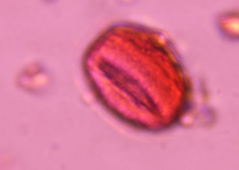 Microscope image of Unknown — pollen (gallery) — verified by PollyMap