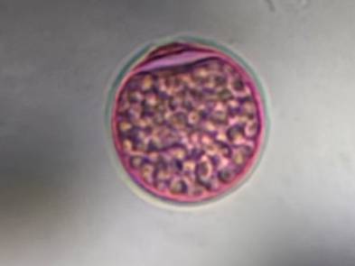 Microscope image of Poaceae — pollen (gallery) — verified by PollyMap