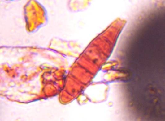 Microscope image of Exserohilum — mold (reference) — verified by PollyMap