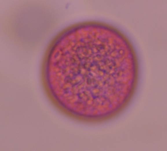 Microscope image of Poaceae — pollen (reference) — verified by PollyMap
