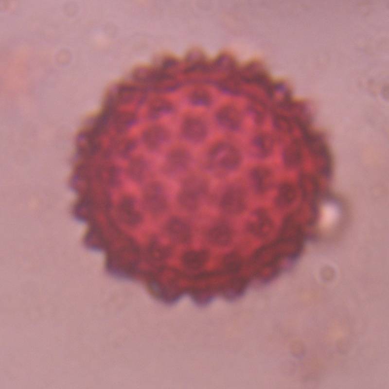 Microscope image of Chenopod — pollen (gallery) — verified by PollyMap
