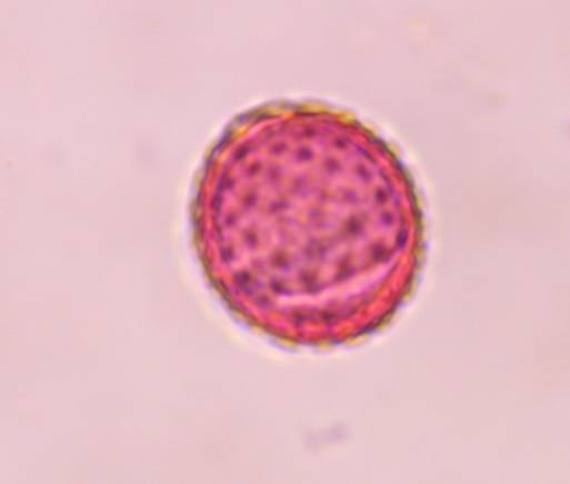 Microscope image of Chenopod — pollen (gallery) — verified by PollyMap