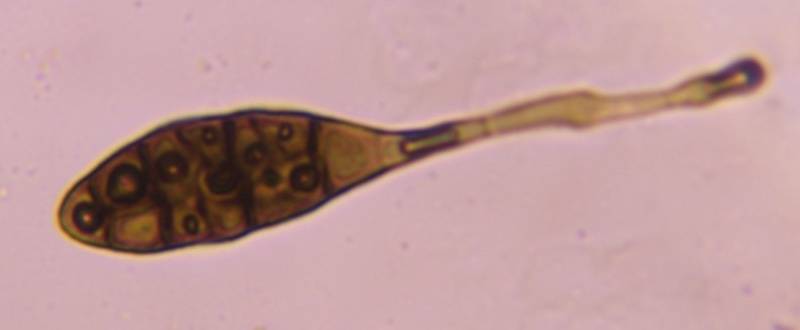 Microscope image of Alternaria — mold (gallery) — verified by PollyMap