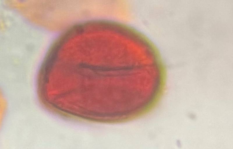 Microscope image of Oak — pollen (gallery) — verified by PollyMap