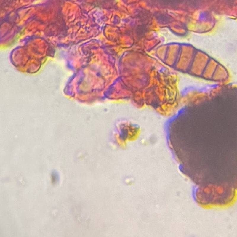 Microscope image of Fungal Spore — mold (gallery) — verified by PollyMap