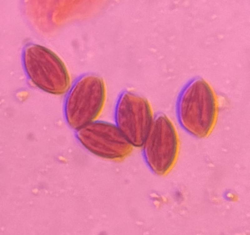 Microscope image of Fungal Spore — mold (reference) — verified by PollyMap