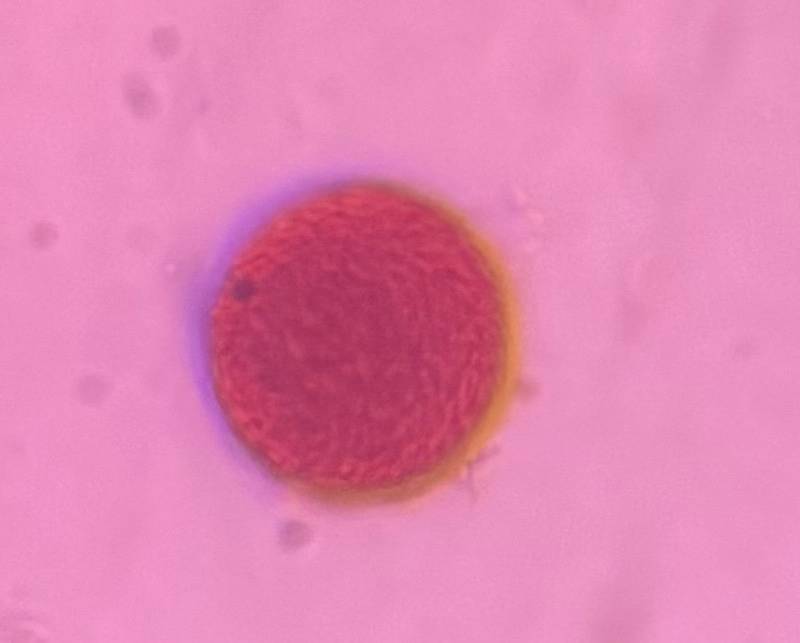 Microscope image of Grass — pollen (gallery) — verified by PollyMap