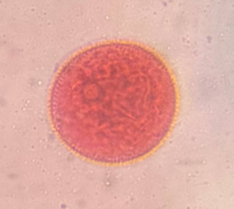 Microscope image of Grass — mold (reference) — verified by PollyMap