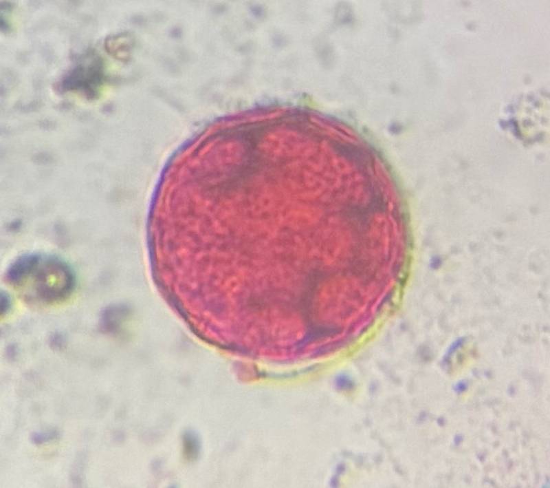 Microscope image of Walnut — pollen (reference) — verified by PollyMap