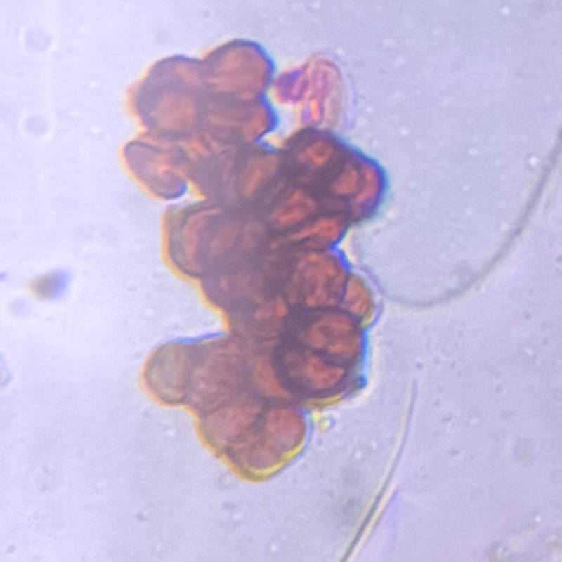 Microscope image of Epicoccum — mold (gallery) — verified by PollyMap