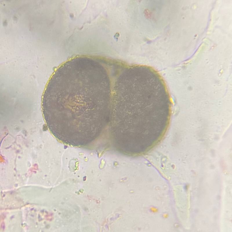 Microscope image of Pine — pollen (gallery) — verified by PollyMap