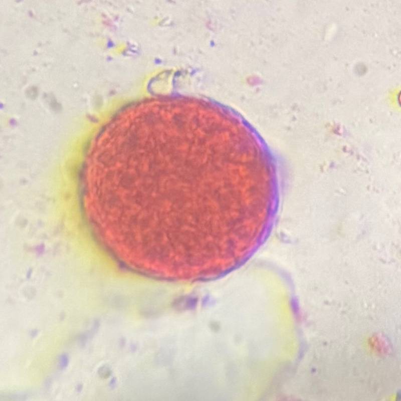 Microscope image of Chenopod — pollen (gallery) — verified by PollyMap