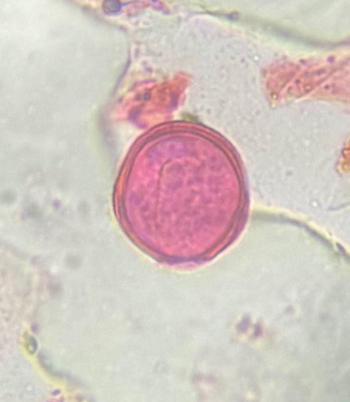 Microscope image of Nettle — pollen (reference) — verified by PollyMap