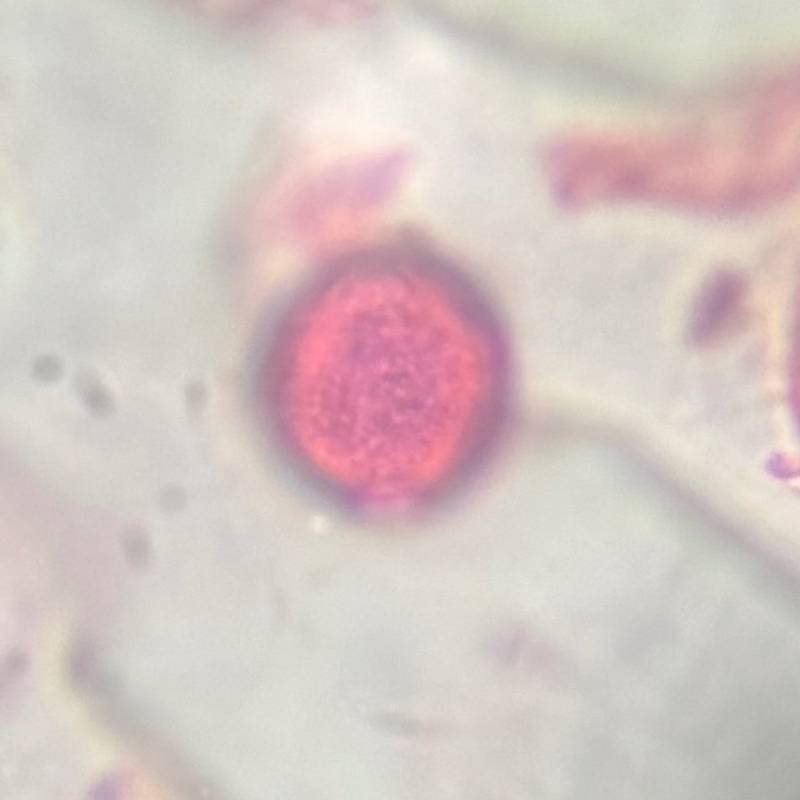 Microscope image of Nettle — pollen (gallery) — verified by PollyMap
