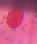Microscope image of unidentified — pollen (gallery) — verified by PollyMap