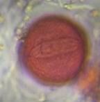 Microscope image of unidentified — pollen (gallery) — verified by PollyMap