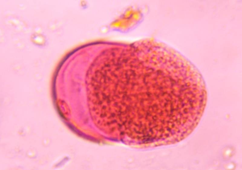 Microscope image of Poaceae — pollen (gallery) — verified by PollyMap