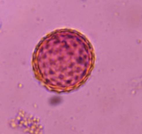 Microscope image of Chenopod — pollen (gallery) — verified by PollyMap