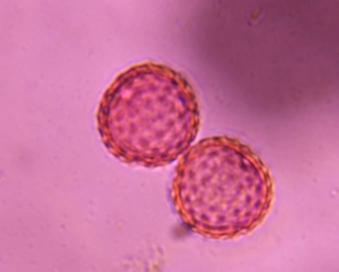 Microscope image of Chenopod — pollen (gallery) — verified by PollyMap