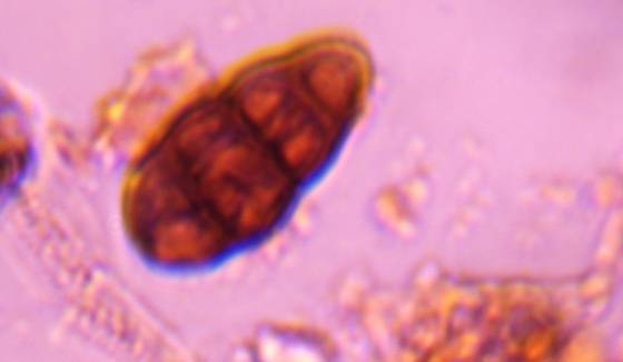 Microscope image of Pithomyces — mold (gallery) — verified by PollyMap