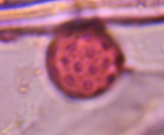 Microscope image of Chenopod Amaranthus — pollen (reference) — verified by PollyMap