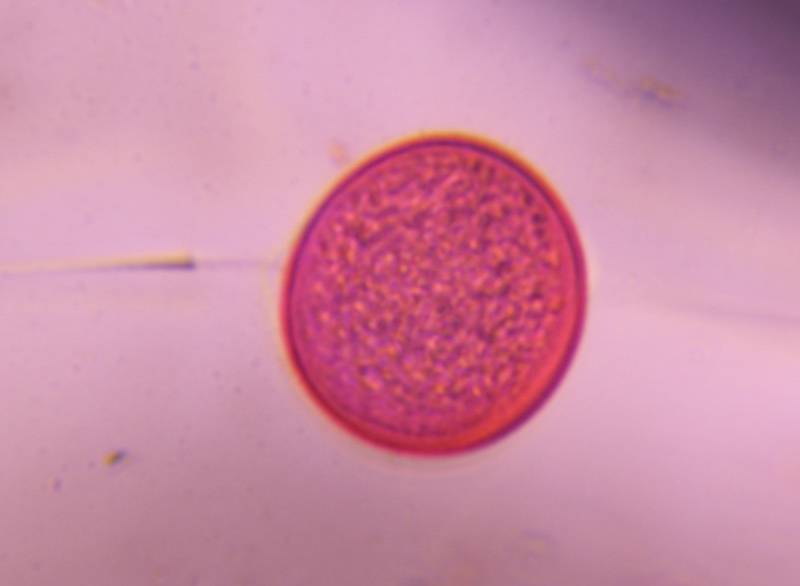 Microscope image of Poaceae — pollen (gallery) — verified by PollyMap