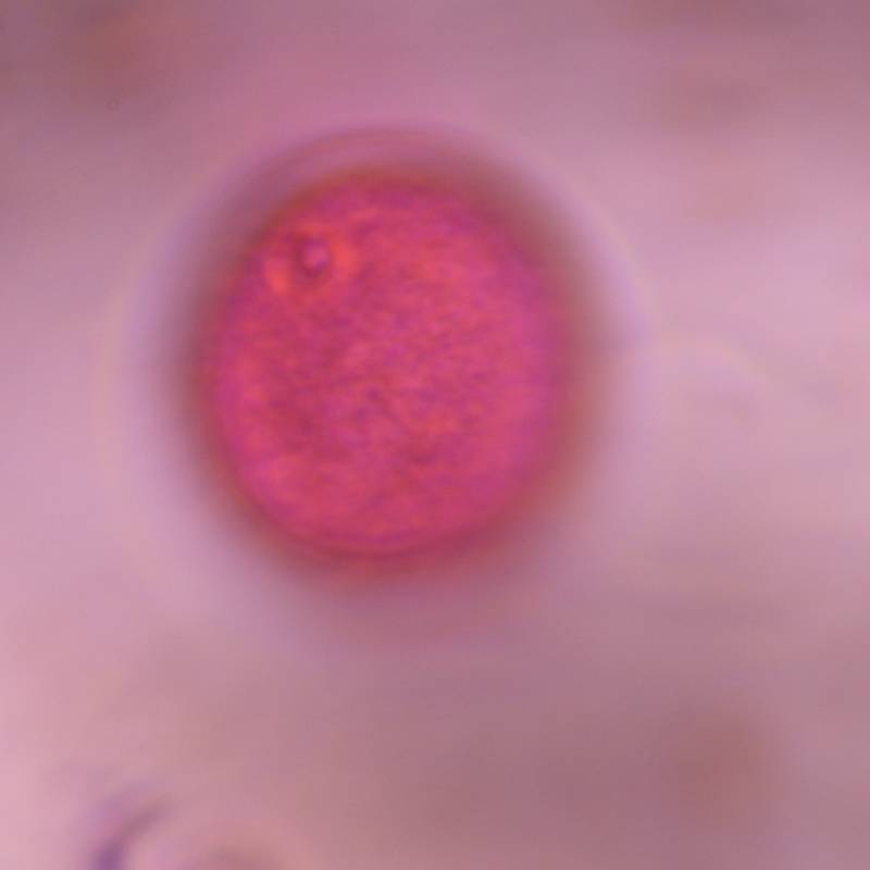 Microscope image of Poaceae — pollen (gallery) — verified by PollyMap