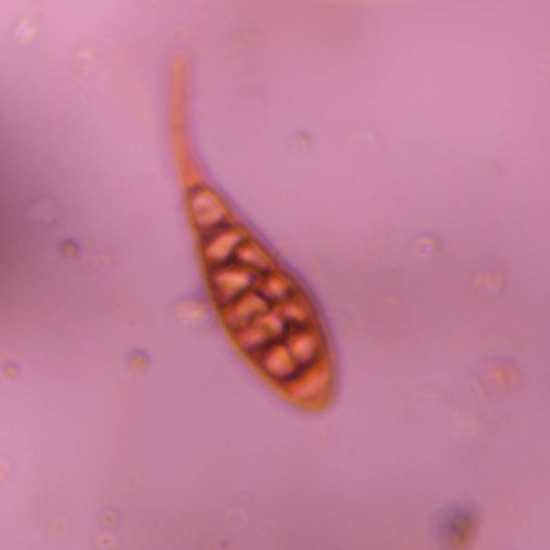Microscope image of Alternaria — mold (gallery) — verified by PollyMap