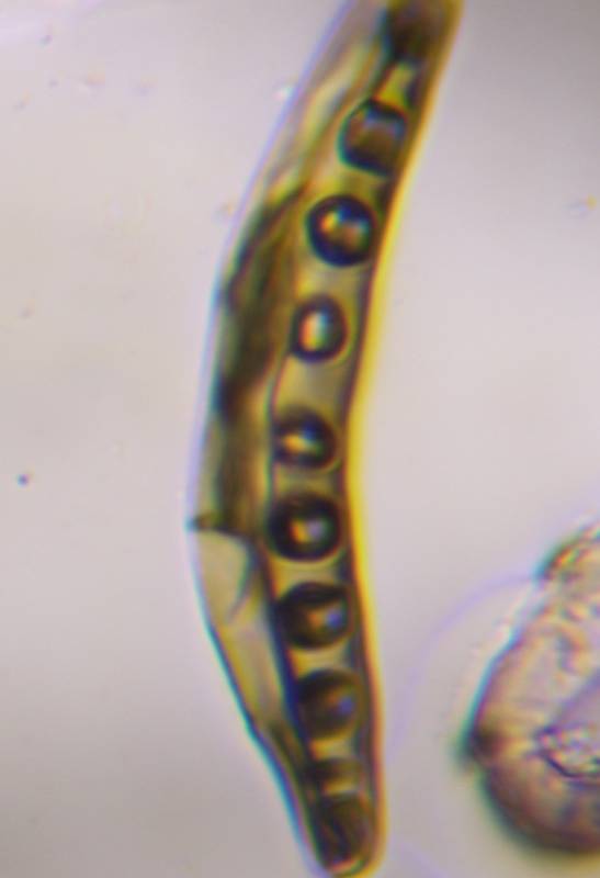 Microscope image of Bipolaris/Drechslera-type — mold (gallery) — verified by PollyMap