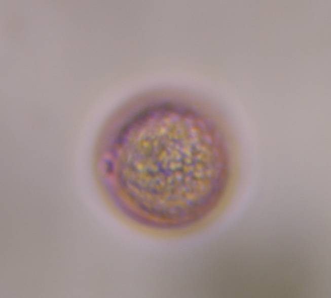 Microscope image of Poaceae — pollen (gallery) — verified by PollyMap