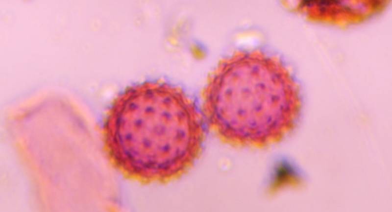 Microscope image of Asteraceae — pollen (gallery) — verified by PollyMap