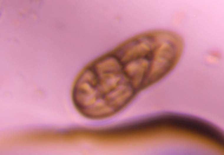 Microscope image of Stemphylium — mold (gallery) — verified by PollyMap