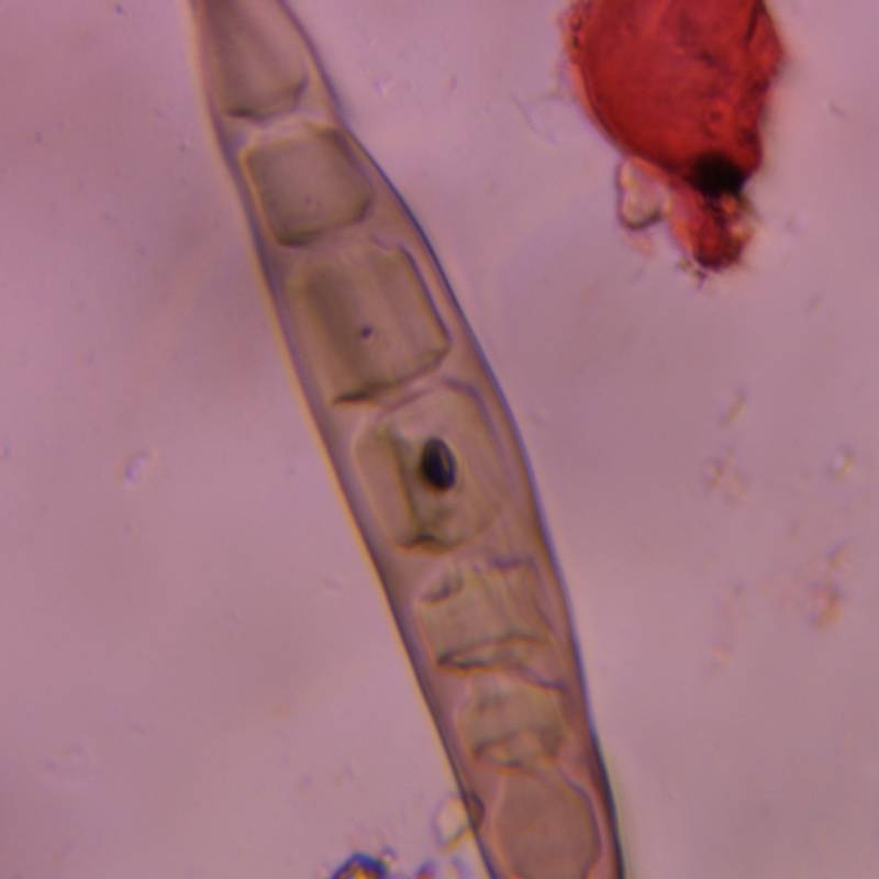 Microscope image of Bipolaris/Drechslera-type — mold (gallery) — verified by PollyMap