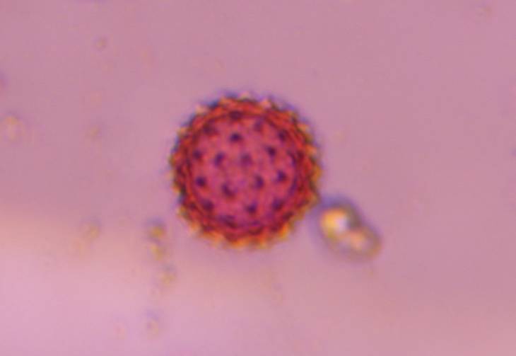 Microscope image of Asteraceae — pollen (gallery) — verified by PollyMap