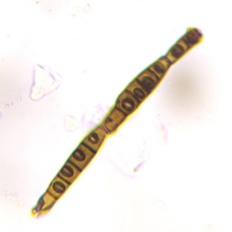 Microscope image of Bipolaris/Drechslera-type — mold (reference) — verified by PollyMap