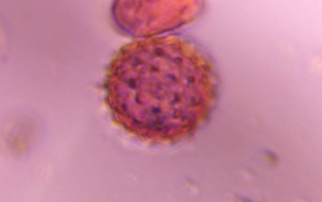 Microscope image of Asteraceae — pollen (gallery) — verified by PollyMap