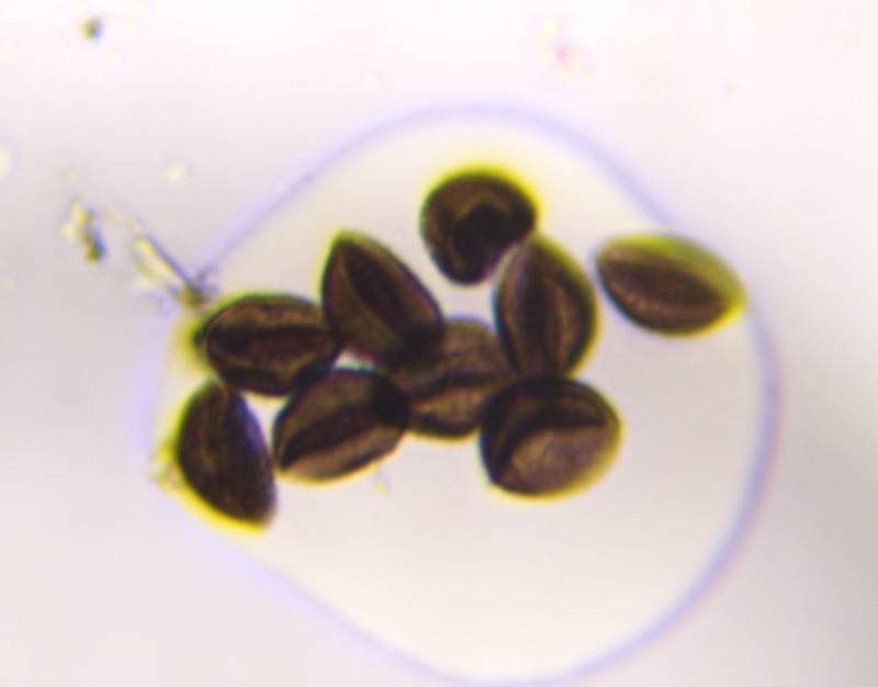 Microscope image of Xylariaceae-type ascospores — mold (reference) — verified by PollyMap