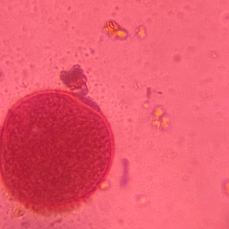 Microscope image of Grass — pollen (gallery) — verified by PollyMap