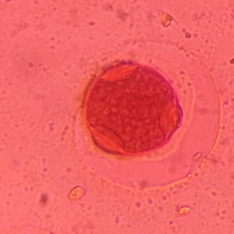 Microscope image of Hackberry — pollen (reference) — verified by PollyMap