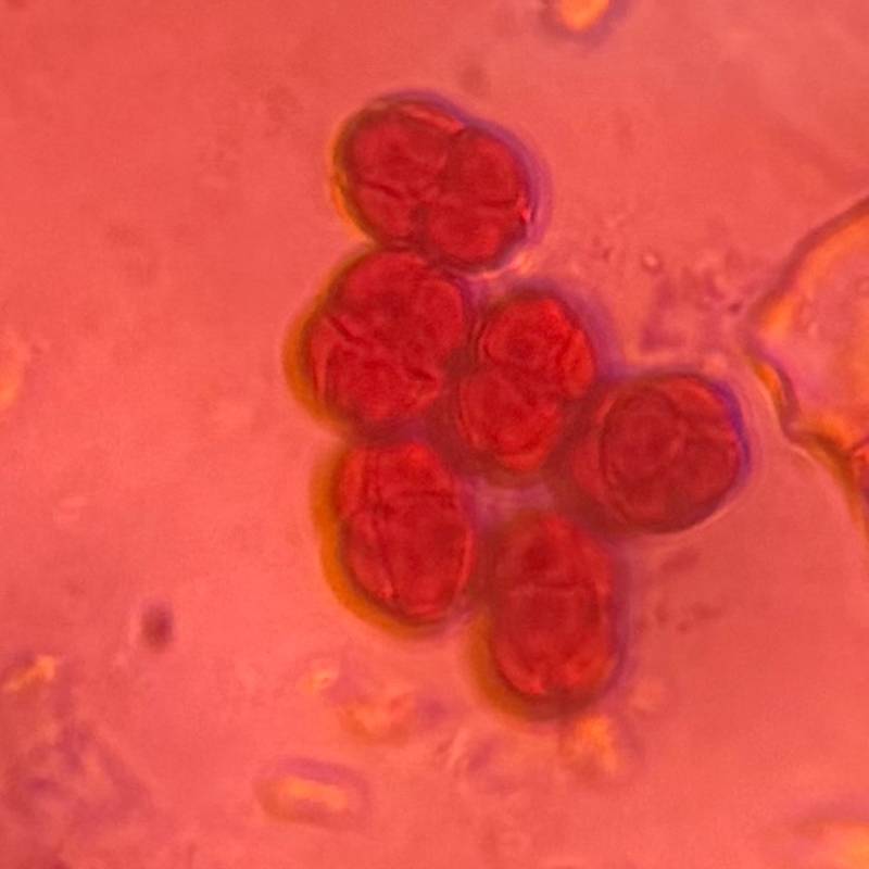 Microscope image of Epicoccum — mold (gallery) — verified by PollyMap