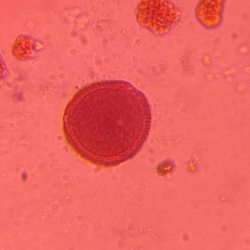 Microscope image of Salix — pollen (reference) — verified by PollyMap