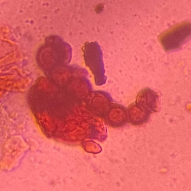 Microscope image of Torula — mold (reference) — verified by PollyMap