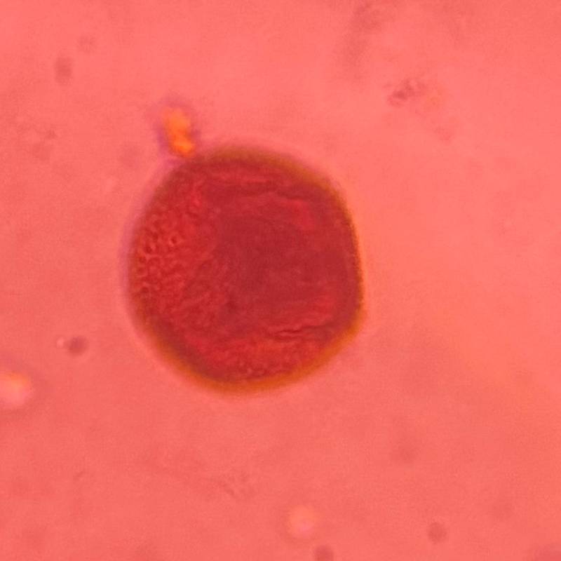 Microscope image of Fabaceae — pollen (reference) — verified by PollyMap