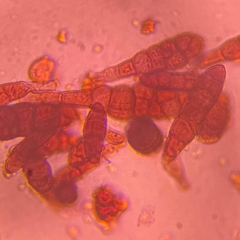 Microscope image of Alternaria — mold (gallery) — verified by PollyMap